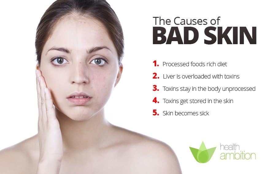 A list titled The Causes of Bad Skin next to a woman looking concerned and touching her face.