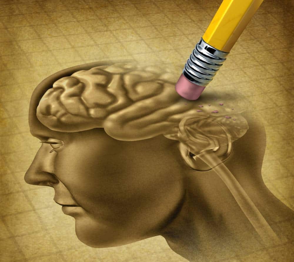 Drawing of a human brain being erased.