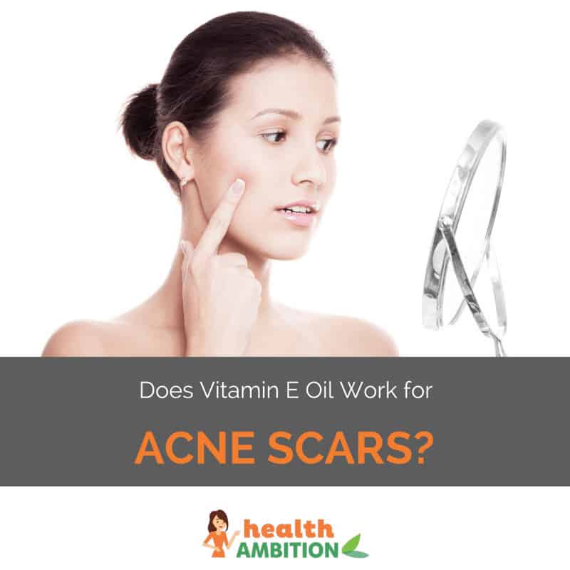 A woman looking at herself in a mirror with the title "Does Vitamin E Oil Work for Acne Scars?"