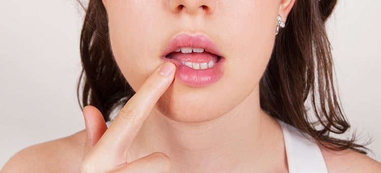 A woman touching the side of her lips with her finger, indicating inflammation.