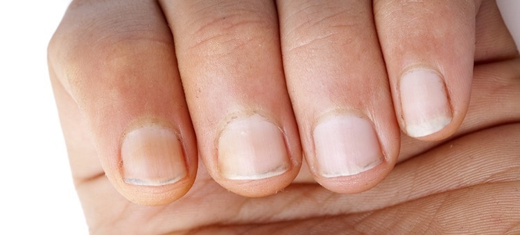 Nails on a person's hand.