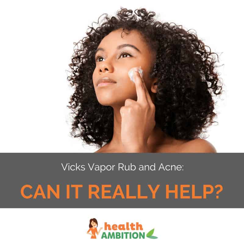 A woman applying vicks vapor rub to her face with the title "Vicks Vapor Rub and Acne: Can It Really Help?"